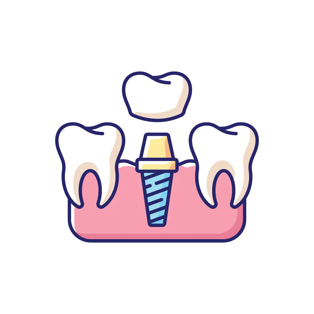 Dental Implants