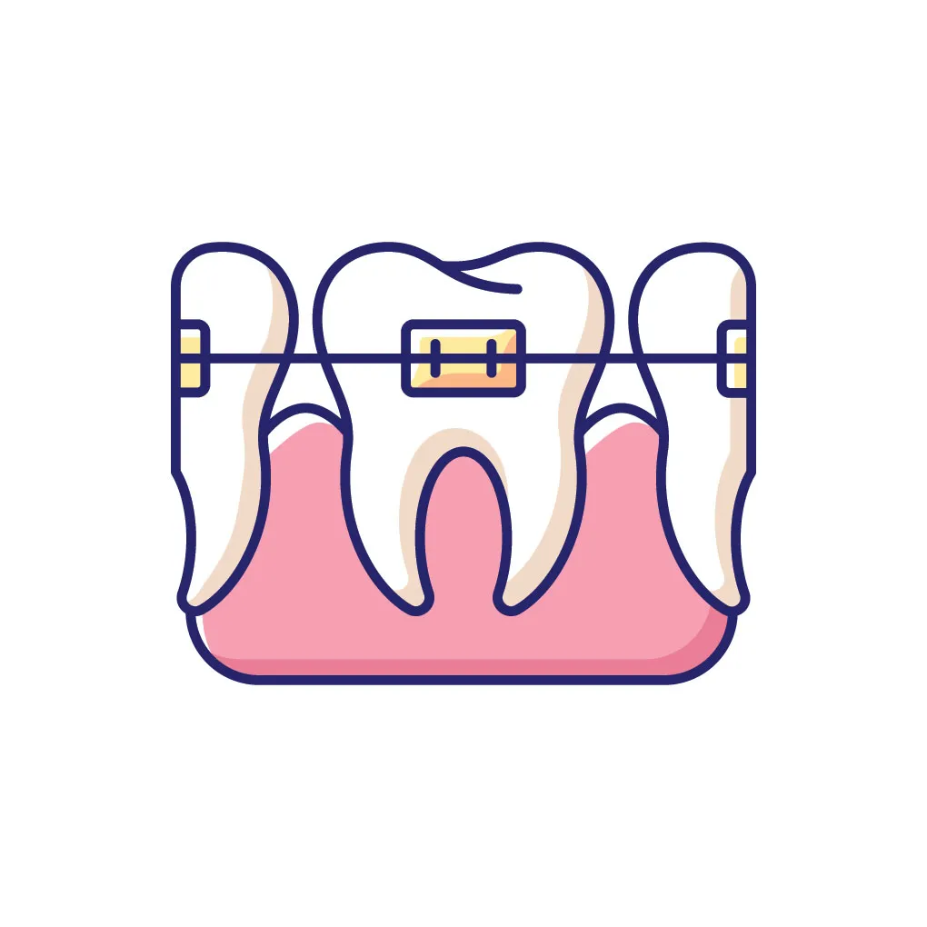 Invisalign