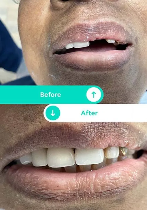 All Smiles Family Dentistry