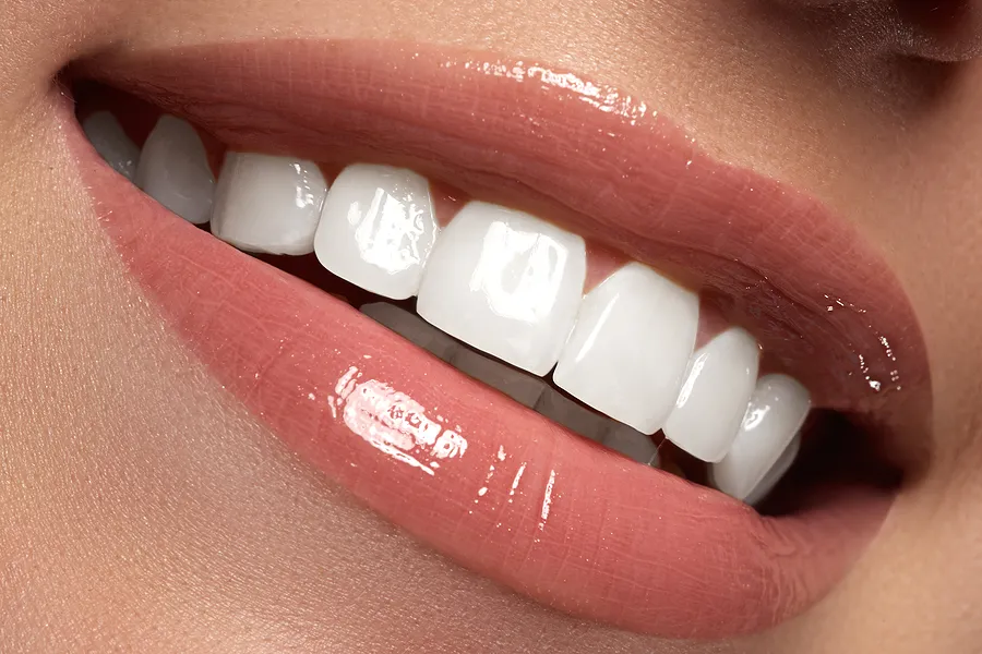 Brighten Your Smile with Teeth Whitening in Tarzana, CA
